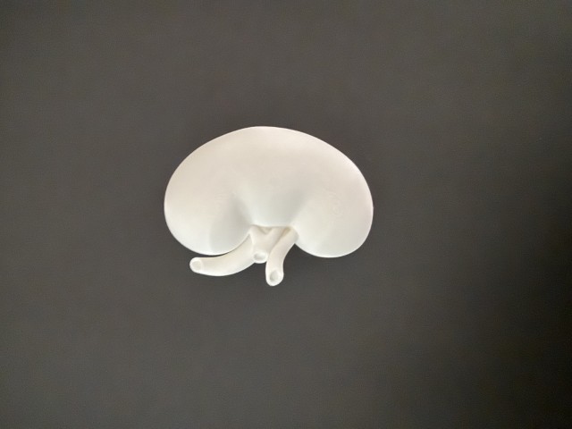 full kidney