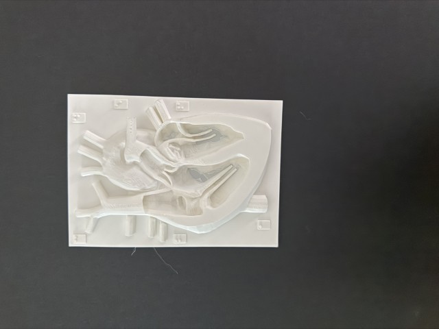 first heart cross section