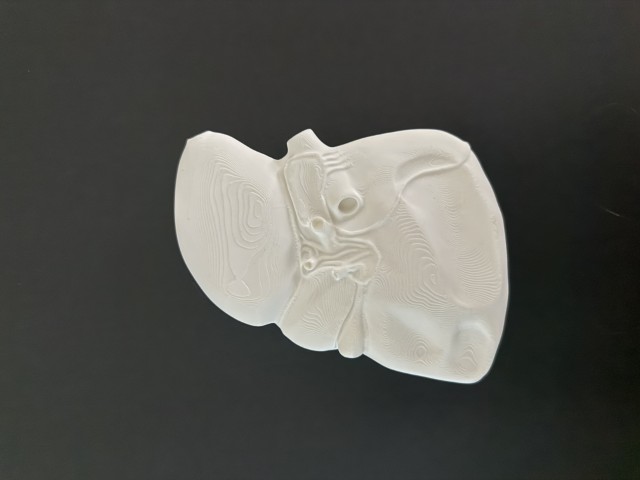 liver cross section with braille